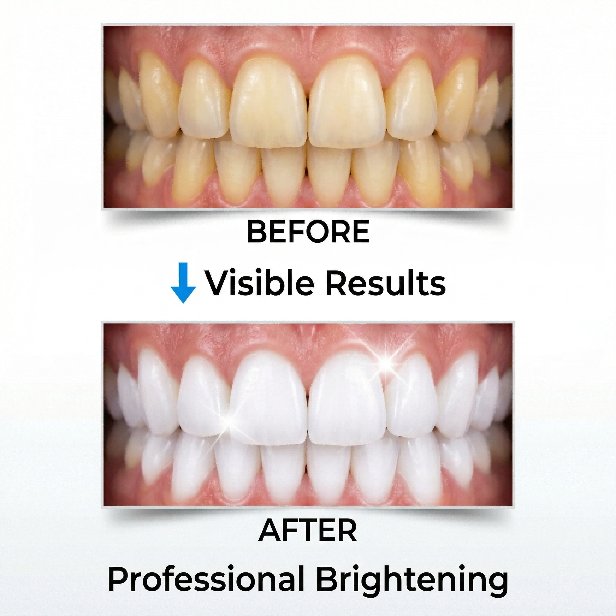 AURAWELL Teeth Whitening Strips for Sensitive Teeth